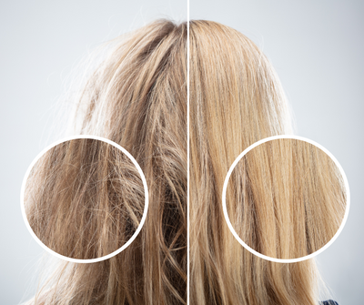 DO IT YOURSELF: vinagre capilar de ortiga y romero | Cosmética casera